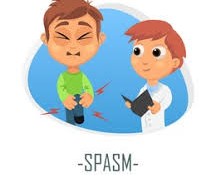 Understanding and Managing Muscle Spasms Understanding and Managing Muscle Spasms